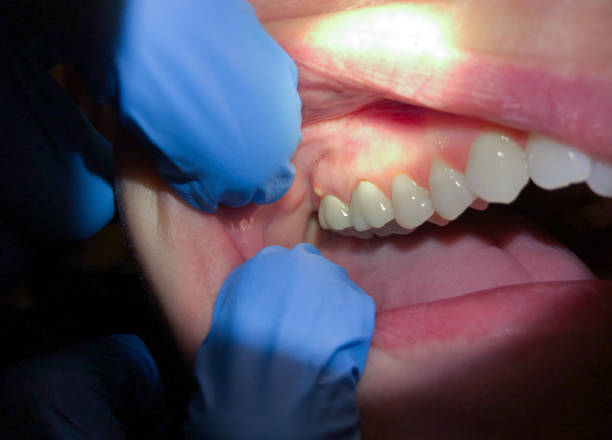 Best Emergency Gum Pain Relief  in Ishpeng, MI